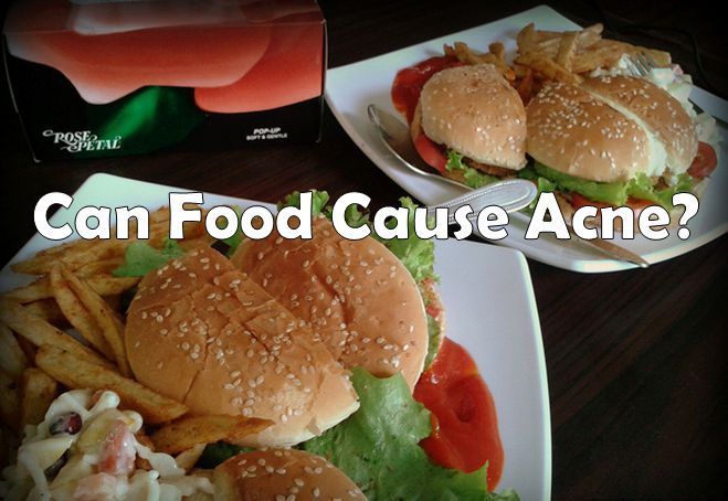 food and acne