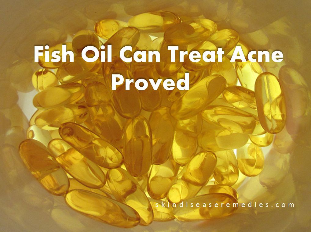 Fish Oil Treats Acne And Why You Should Not Use It Skin Disease