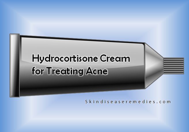 Cortisone Cream for Treating Acne - Skin Disease Remedies