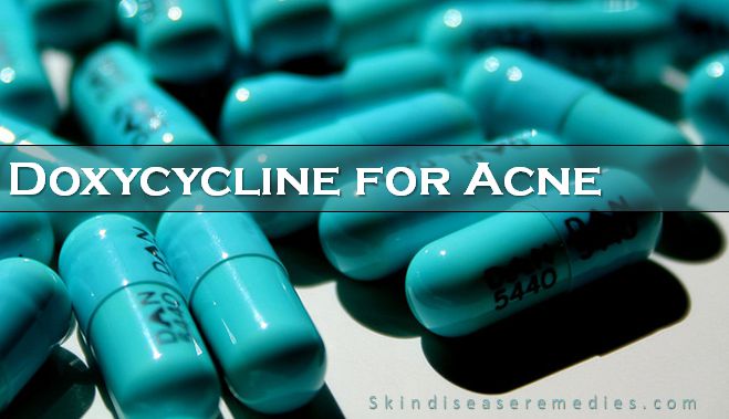 doxycycline for acne