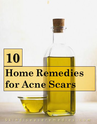 home remedies for acne scars