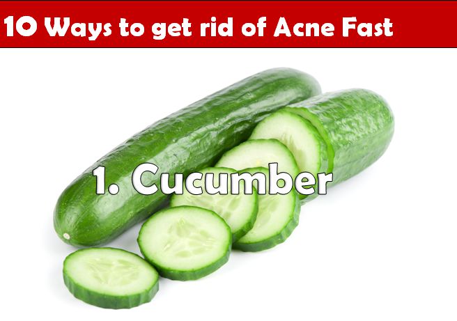 how to get rid of acne fast - cucumber
