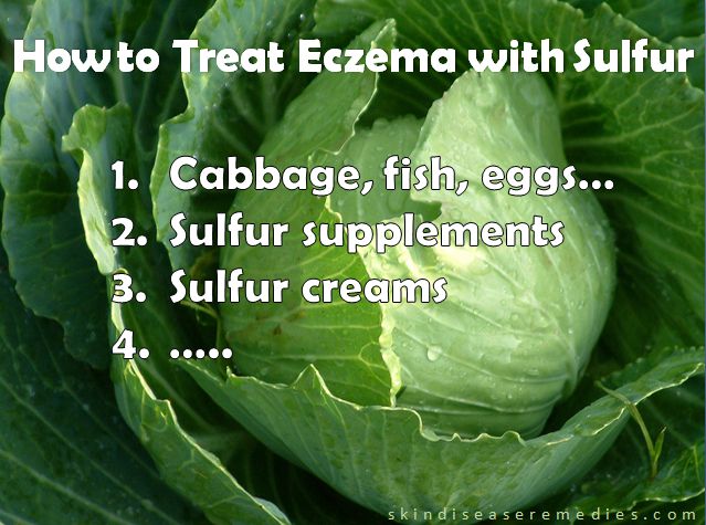 how to treat eczema with sulfur