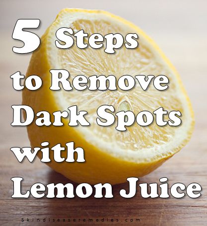 lemon jucie for dark spots