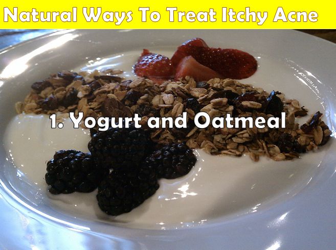 yogurt and oatmeal for itchy acne