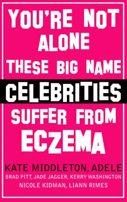 celebrities with eczema