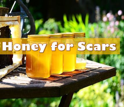 honey for acne scars