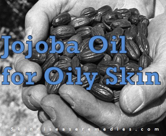 jojoba oil for oily skin