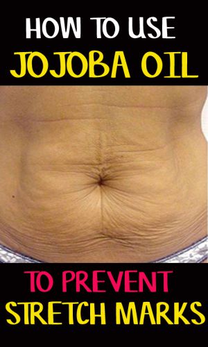 jojoba oil for stretch marks