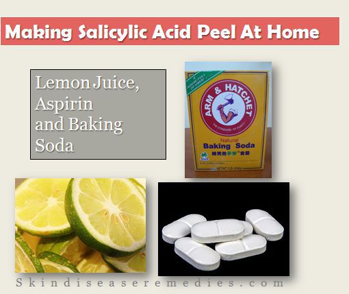 salicylic acid peel at home