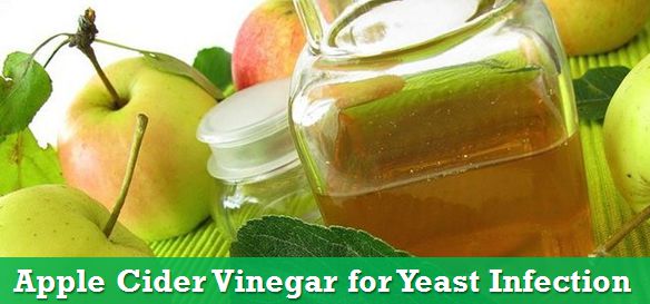 apple cider vinegar for yeast infection