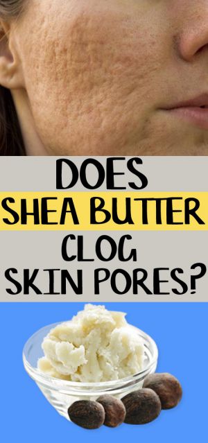 does shea butter clog skin pores
