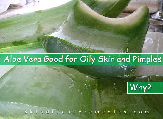 is aloe vera good for oily skin