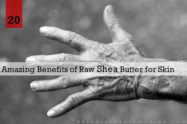 raw shea butter benefits for skin