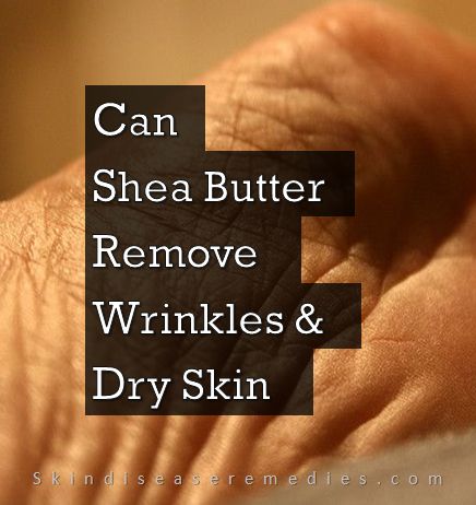 shea butter for wrinkles and dry skin