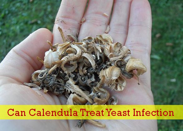 calendula for yeast infection