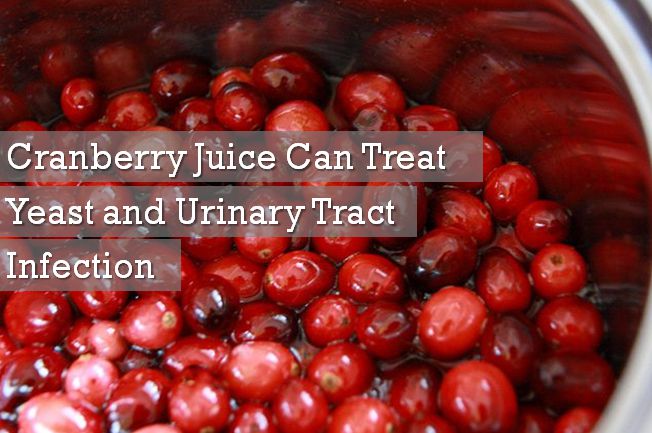 cranberry juice for yeast infection
