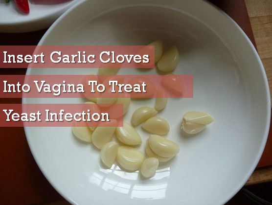 garlic for yeast infection