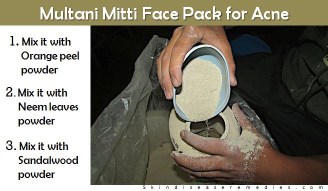multani mitti face pack for acne and oily skin