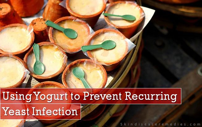 yogurt for yeast infection