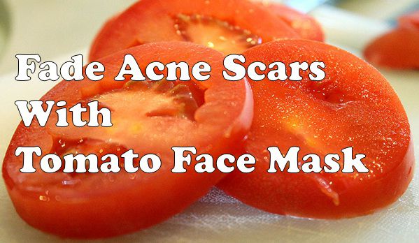 tomato face mask for acne scars