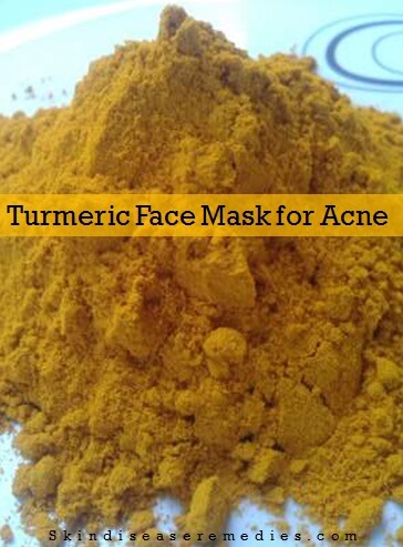 turmeric face mask for acne and acne scars