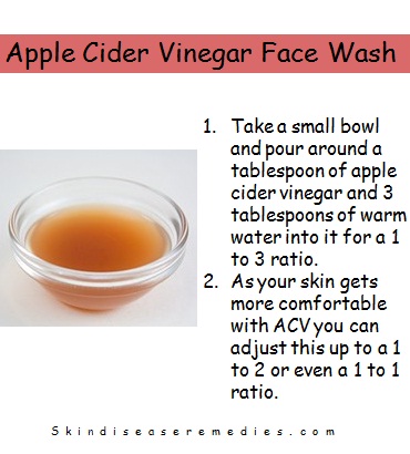 apple cider vinegar face wash