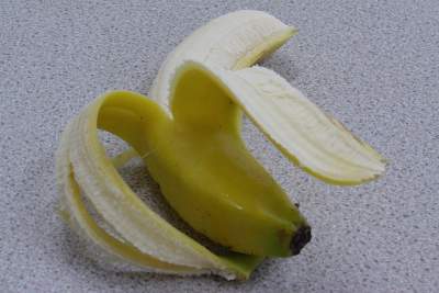 banana peel for mosquito bite