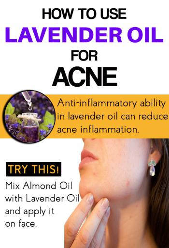 How to Use Lavender Oil for Acne and Acne Scars? 10 Methods