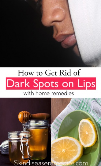 how to get rid of dark spots on lips fast