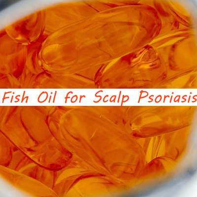 fish oil for scalp psoriasis copy