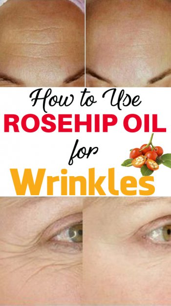 rosehip oil for wrinkles, eye