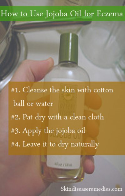 How to Use Jojoba Oil for Eczema – 10 Methods