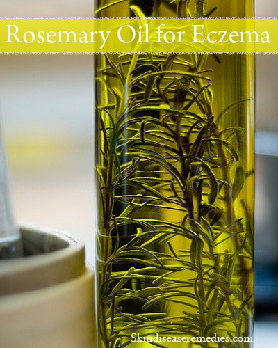 rosemary oil for eczema and psoriasis