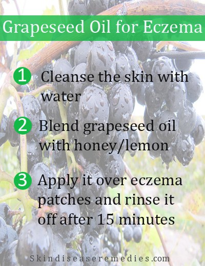 How to Use Grapeseed Oil for Eczema – 6 DIY Methods