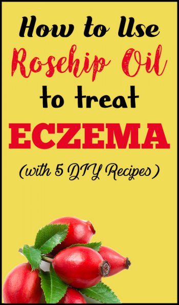 is rosehip oil good for eczema