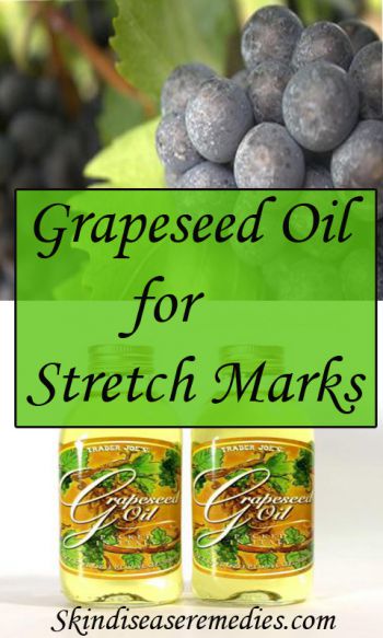 grapseed oil and argan oil stretch marks