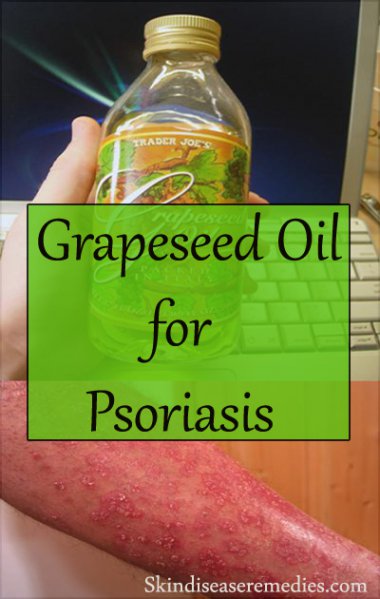 grapeseed-oil-for-psoriasis