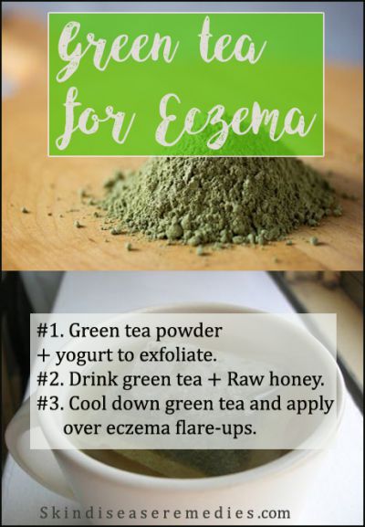 How to Use Green Tea for Eczema – 7 Excellent Recipes
