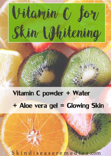 vitmain-c-for-skin-whitening