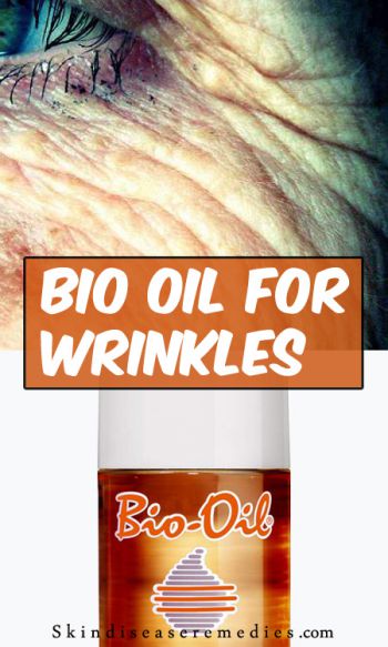 bio-oil-for-wirnkels