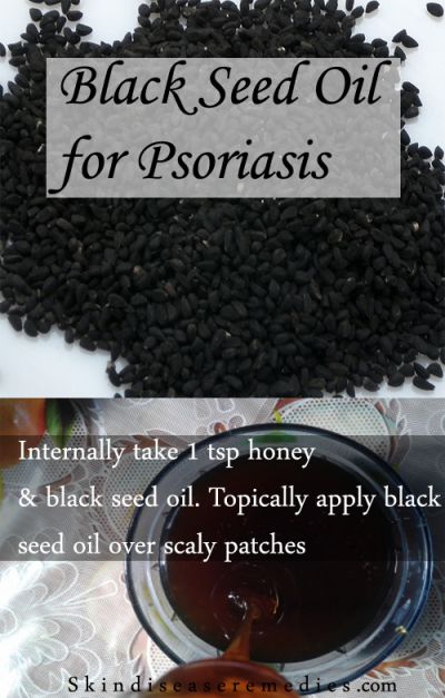 black-seed-oil-for-psoriasis