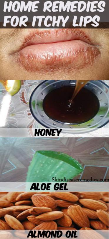 home-remedies-for-itchy-lips