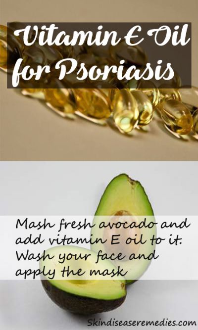 vitamin-e-oil-for-psoriasis