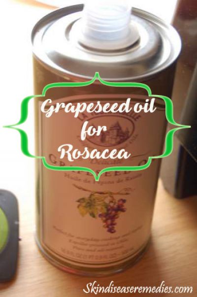 grapeseed-oil-for-rosacea