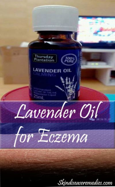 lavender-oil-for eczema