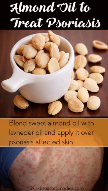 almond-oil-for-psoriasis