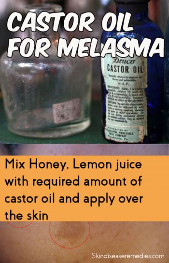 castor-oil-for-melasma