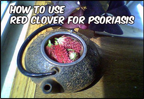 red-clover-for-psoriasis