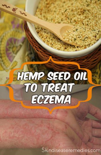 hemp seed oil for eczema